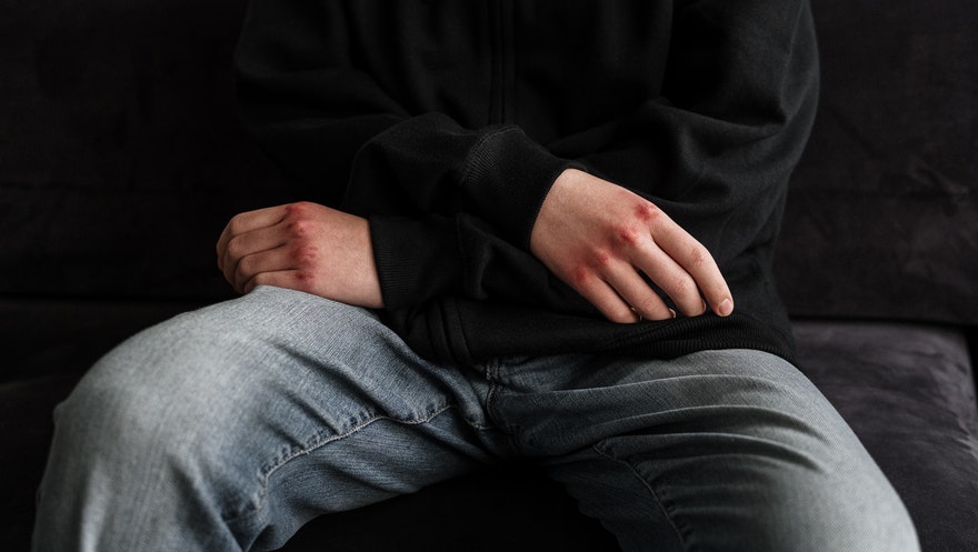 A cultura dos trotes violentos